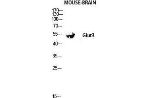 Western Blot (WB) analysis of Mouse Kidney lysis using Glut3 antibody.