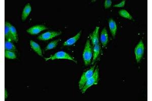 Immunofluorescent analysis of Hela cells using ABIN7159700 at dilution of 1:100 and Alexa Fluor 488-congugated AffiniPure Goat Anti-Rabbit IgG(H+L) (MCPH1 antibody  (AA 536-835))