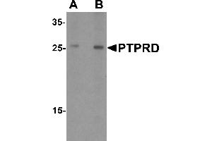 Western blot analysis of PTPRD in HeLa cell lysate with PTPRD antibody at (A) 1 and (B) 2 µg/mL.