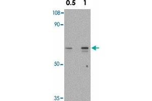 Western blot analysis of SNW1 in mouse skeletal muscle tissue lysate with SNW1 polyclonal antibody  at 0.