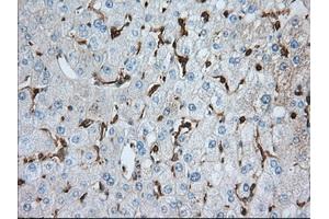 Immunohistochemical staining of paraffin-embedded prostate tissue using anti-ALDH3A1 mouse monoclonal antibody. (ALDH3A1 antibody)