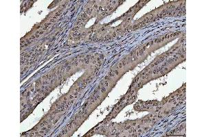 IHC analysis of PC4/SUB1 using anti-PC4/SUB1 antibody (ABIN4886733). (SUB1 antibody  (C-Term))