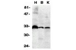 Western Blotting (WB) image for anti-Tumor Necrosis Factor Receptor Superfamily, Member 6b, Decoy (TNFRSF6B) (N-Term) antibody (ABIN1031347)