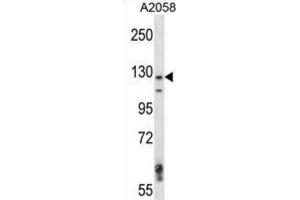 Western Blotting (WB) image for anti-Mitogen-Activated Protein Kinase Kinase Kinase 6 (MAP3K6) antibody (ABIN2997620) (MAP3K6 antibody)