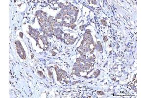 IHC analysis of C18orf22/RBFA using anti-C18orf22/RBFA antibody (ABIN7600106).