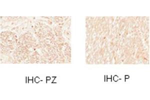 Sample Type:  Human Optic Nerve and Spinal CordCellular Target: Oligoden Drocyte Lineage cells   Dilution:  1:1000 (MYT1 antibody  (N-Term))