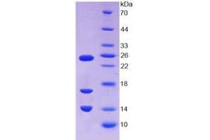 SDS-PAGE analysis of Human CAMP Protein. (Cathelicidin Antimicrobial Peptide (CAMP) Peptide)