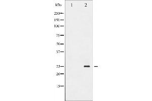 Western blot analysis of TNNI3 phosphorylation expression in Jurkat whole cell lysates,The lane on the left is treated with the antigen-specific peptide. (TNNI3 antibody  (pSer44))