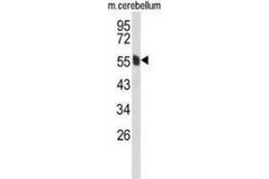 Western blot analysis of MPP6 (arrow) in mouse cerebellum tissue lysates (35ug/lane) using MPP6