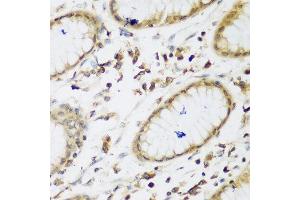 Immunohistochemistry of paraffin-embedded human gastric using UBE3A antibody at dilution of 1:200 (40x lens).