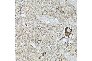Immunohistochemistry of paraffin-embedded human brain using [KO Validated] Calreticulineticulin Rabbit pAb (ABIN3021344, ABIN3021345, ABIN3021346 and ABIN6214923) at dilution of 1:100 (40x lens). (Calreticulin antibody)