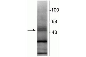 Western blot of rat hippocampal lysate showing specific immunolabeling of the ~48 kDa RAR-β isotype. (Retinoic Acid Receptor beta antibody  (N-Term))