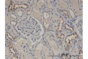 Image no. 2 for anti-Calmodulin-Like 5 (CALML5) (AA 1-147) antibody (ABIN599566) (CALML5 antibody  (AA 1-147))