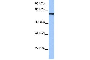 WB Suggested Anti-MLLT3 Antibody Titration:  0.