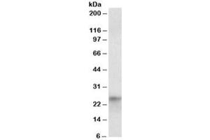 Western blot testing of HepG2 nuclear lysate with HES4 antibody at 1ug/ml. (HES4 antibody)