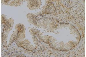 ABIN6277903 at 1/100 staining Mouse colon tissue by IHC-P. (UCP1 antibody  (Internal Region))