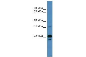 WB Suggested Anti-BASP1 Antibody Titration: 0.
