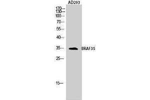 Western Blotting (WB) image for anti-High Mobility Group 20B (HMG20B) (N-Term) antibody (ABIN3183539) (HMG20B antibody  (N-Term))