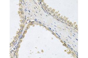 Immunohistochemistry of paraffin-embedded Human prostate using POMGNT1 Polyclonal Antibody at dilution of 1:100 (40x lens). (POMGNT1 antibody)