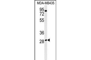 Western blot analysis of RRAGD Antibody (Center) (ABIN651150 and ABIN2840101) in MDA-M cell line lysates (35 μg/lane). (RRAGD antibody  (AA 171-199))