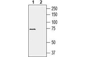 Western blot analysis of human liver carcinoma HepG2 cell line lysate (lanes 1 and 2): - 1. (SLC41A2 antibody  (Extracellular, N-Term))
