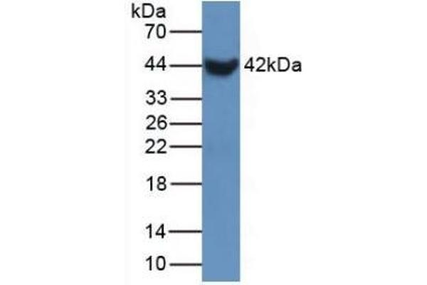SFTPB Antikörper  (AA 20-193)