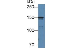 Detection of COL4a5 in Porcine Cerebrum lysate using Polyclonal Antibody to Collagen Type IV Alpha 5 (COL4a5) (COL4a5 antibody  (AA 1461-1685))