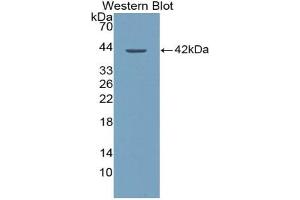 Western blot analysis of the recombinant protein. (XCL1 antibody  (AA 23-113))