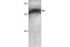 Western blot analysis of human fetal brain lysate with ADAM10 polyclonal antibody  at 1 : 1000 dilution. (ADAM10 antibody  (C-Term))