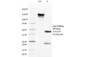 SDS-PAGE Analysis Purified Aurora B Mouse Monoclonal Antibody (AURKB/1592). (Aurora Kinase B antibody  (AA 89-251))