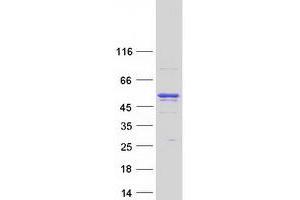 ANKFY1 Protein (Transcript Variant 2) (Myc-DYKDDDDK Tag)