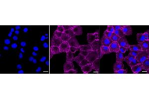 Immunocytochemical staining of HT- cells with PAG1 antibody (ABIN7799831), 1:1,000).