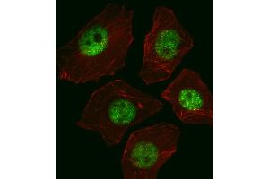 Fluorescent image of A549 cell stained with SOX2 Antibody (ABIN387798 and ABIN2843854)/SG110310. (SOX2 antibody)