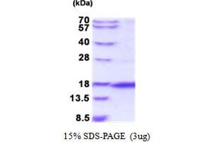 SDS-PAGE (SDS) image for Otoraplin (OTOR) (AA 26-128) protein (His tag) (ABIN5854143)