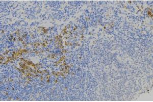 ABIN6277802 at 1/100 staining Human lymph node tissue by IHC-P. (S100A9 antibody)