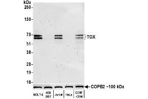 Western Blotting (WB) image for anti-Thymus High Mobility Group Box Protein (TOX) (AA 50-100) antibody (ABIN7453374)