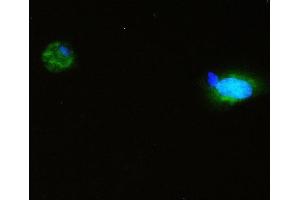 IF analysis of SQSTM1 using anti-SQSTM1 antibody (ABIN3043937). (SQSTM1 antibody  (N-Term))