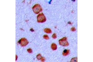 Immunohistochemical analysis of GAP43 staining in human brain formalin fixed paraffin embedded tissue section. (GAP43 antibody  (N-Term))