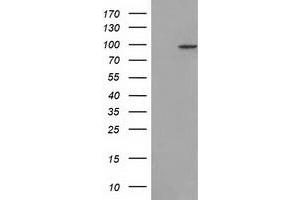 HEK293T cells were transfected with the pCMV6-ENTRY control (Left lane) or pCMV6-ENTRY CDCP1 (Right lane) cDNA for 48 hrs and lysed. (CDCP1 antibody)