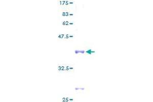 RPL35 Protein (GST tag)