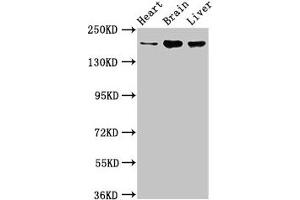 Western Blot Positive WB detected in: Rat heart tissue, Mouse brain tissue, Mouse liver tissue All lanes: ARFGEF2 antibody at 3. (ARFGEF2 antibody  (AA 200-317))