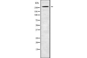 Western blot analysis NAV3 using HepG2 whole cell lysates (NAV3 antibody  (Internal Region))