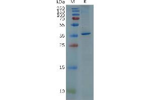 GFAP Protein (AA 68-377) (His tag)