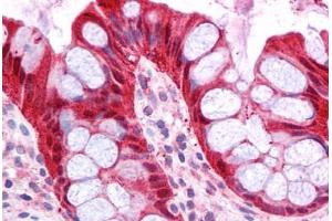 Human Colon: Formalin-Fixed, Paraffin-Embedded (FFPE)