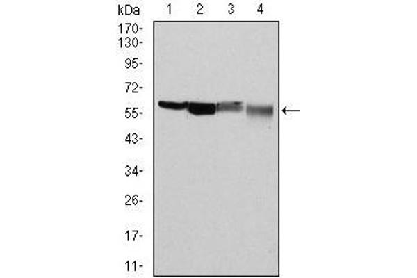 Glucose-6-Phosphate Dehydrogenase antibody