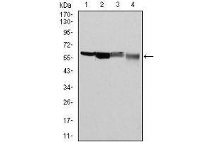 Western blot analysis using G6PD mouse mAb against Hela (1), MCF-7 (2), Jurkat (3) and K562 (4) cell lysate.