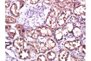 Paraformaldehyde-fixed, paraffin embedded human kidney, Antigen retrieval by boiling in sodium citrate buffer (pH6. (SLC10A2 antibody  (AA 131-230))