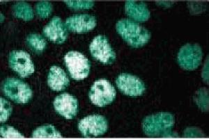 Immunofluorescence staining of A431 cells (Human epithelial carcinoma, ATCC CRL-1555). (CTCF antibody  (AA 184-290))