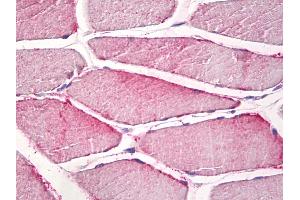 Anti-CPNE6 / N-COPINE antibody IHC staining of human skeletal muscle. (CPNE6 antibody)