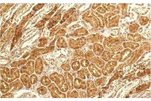 Immunohistochemistry of paraffin-embedded Human kidney tissue using IL8 Monoclonal Antibody at dilution of 1:200. (IL-8 antibody)